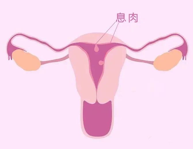 千萬別忽視求子路上的這個“攔路虎”！